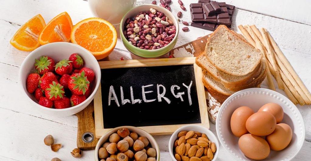 Food Allergen Awareness & Benedict’s Law Certification