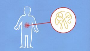 Sepsis Awareness Certification - Cutout paper composition representing sick human figure with viral infection in stomach on blue background