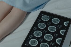 Epilepsy Awareness Certification - Close-up of brain CT scan display on tablet beside patient's legs in a hospital room.